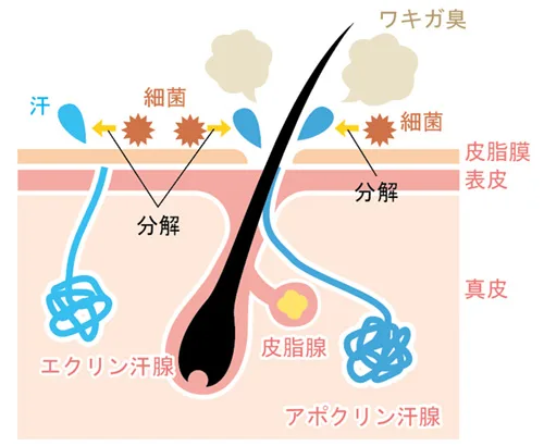 ワキガ臭発生の原因